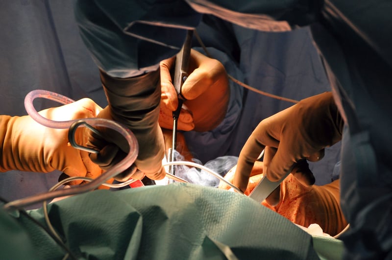 operation bow leg correction surgery blog .jpg