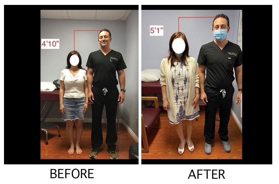 The Chandler Project A Height Lengthening Journey