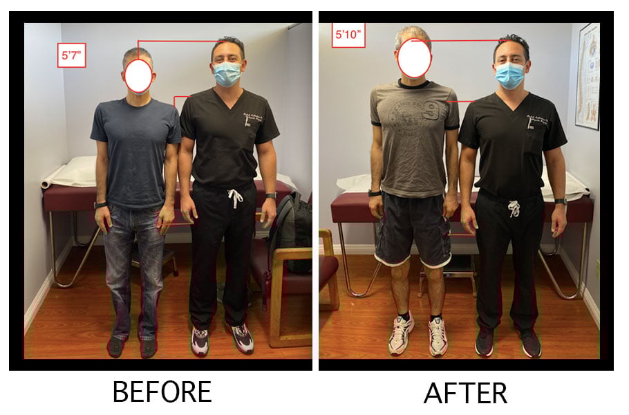 The Chandler Project A Height Lengthening Journey