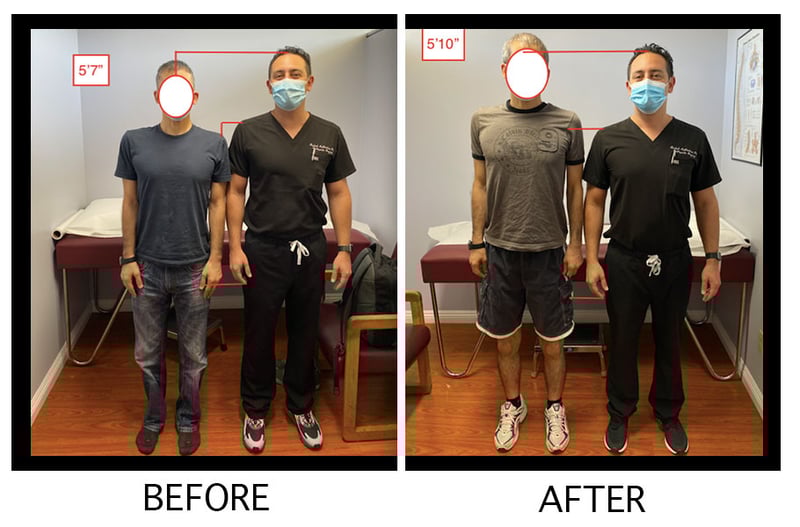 The Chandler Project A Height Lengthening Journey