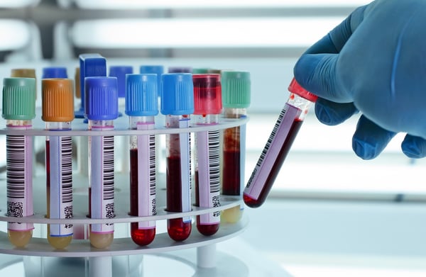 plasma rich platelet therapy centrifuge blood type.jpg