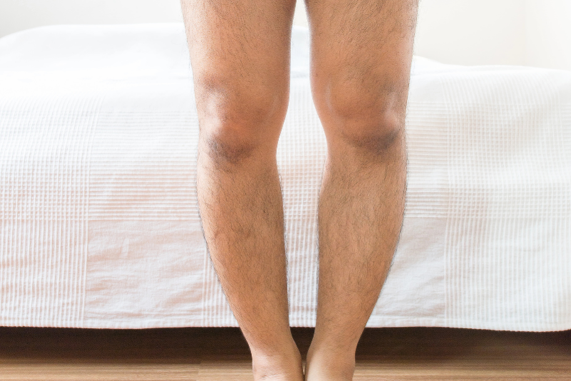 ¿Corregir las piernas arqueadas puede hacerte más alto?