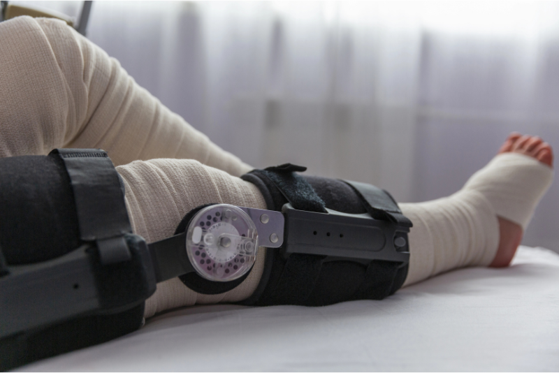 Understanding Your Responsibilities After Height Lengthening Surgery