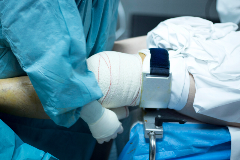 Age Limits for Limb Lengthening Surgery: Minimum & Maximum Age Requirements